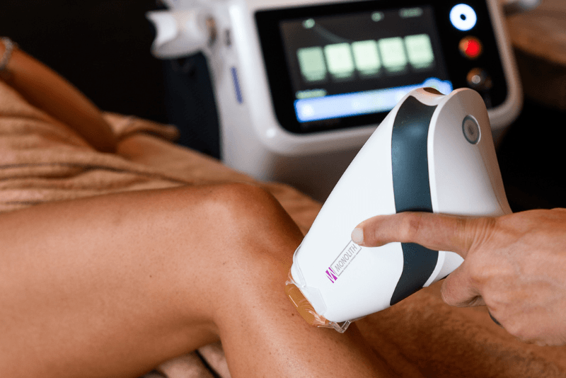 Laser Mezza Gamba Donna